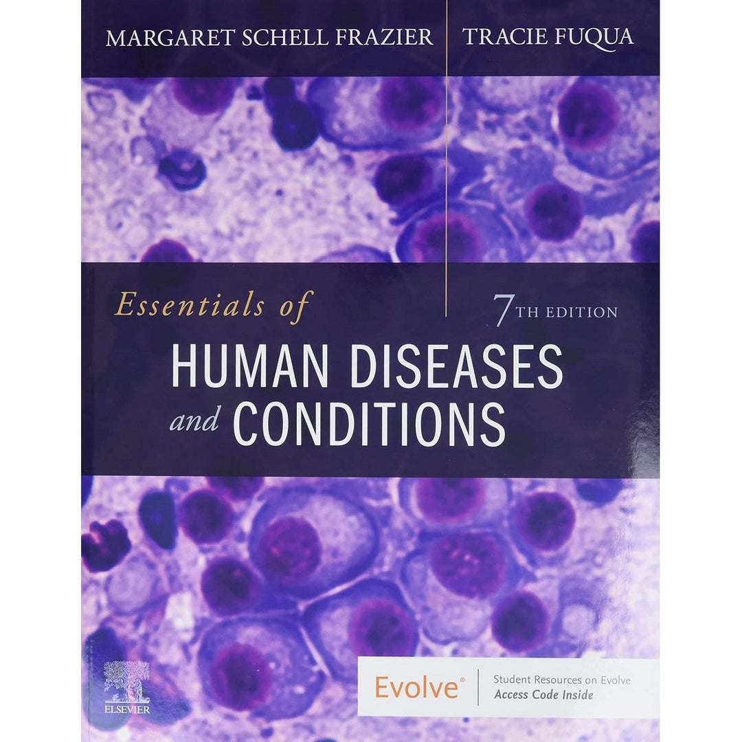 Essentials of Human Diseases and Conditions (7E 21)
